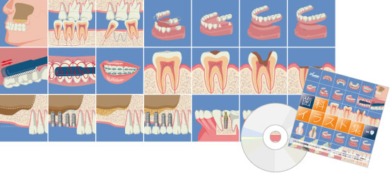 歯科イラスト集CDイメージ